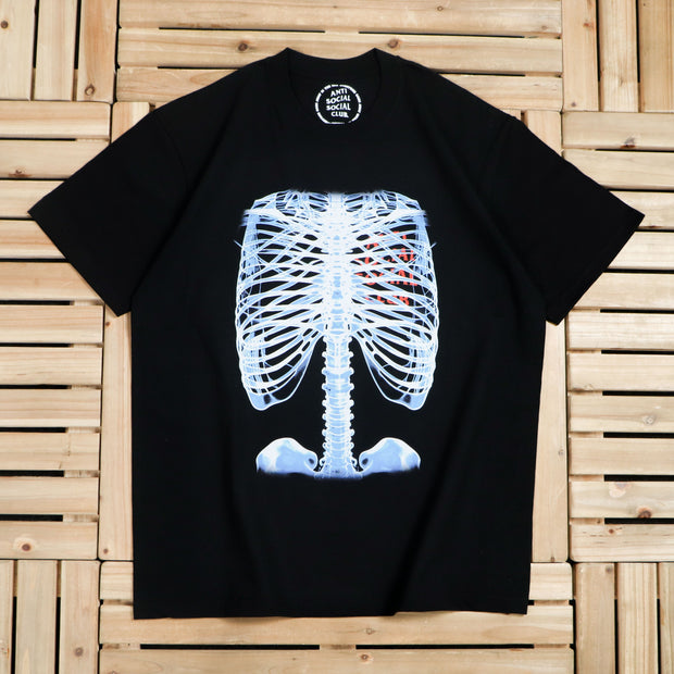 Anti Social Social Club Tee